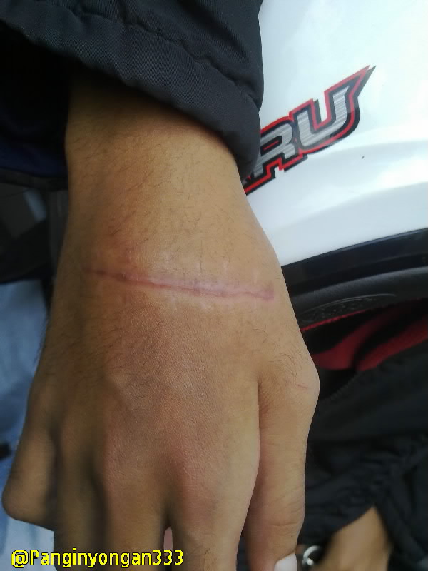 korban geng motor.jpg